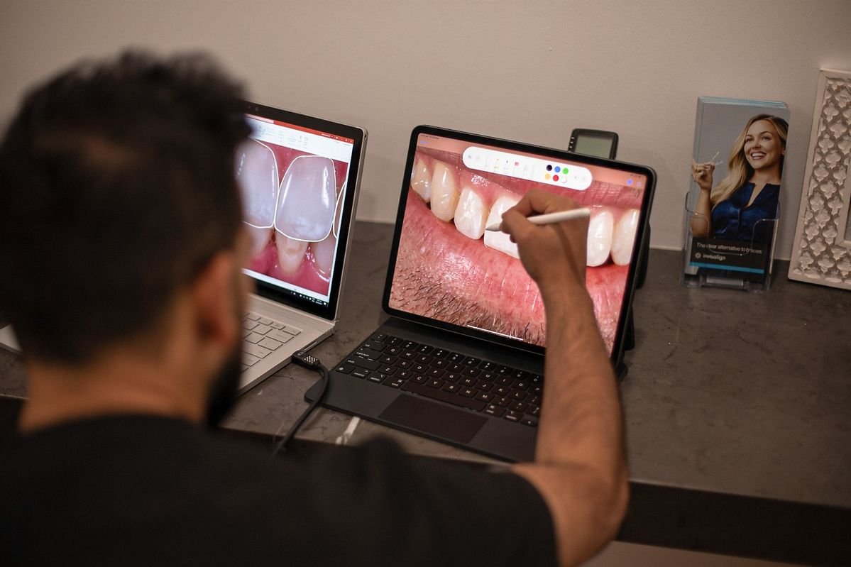 Digital Scanning Technique