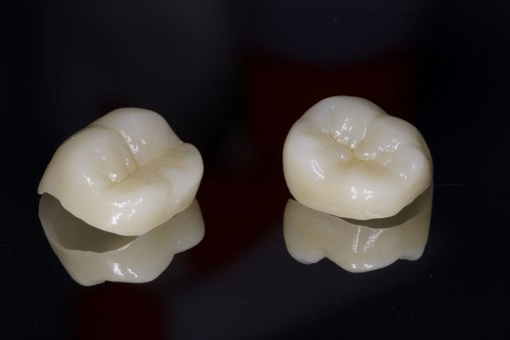 Emax Crown