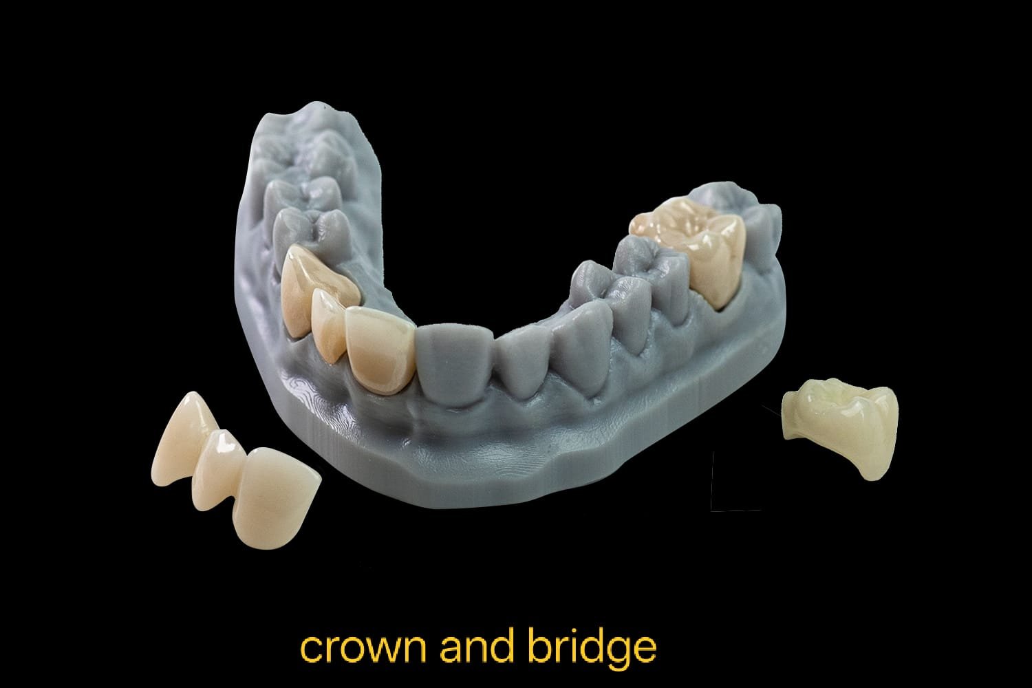 Crown and Brideges